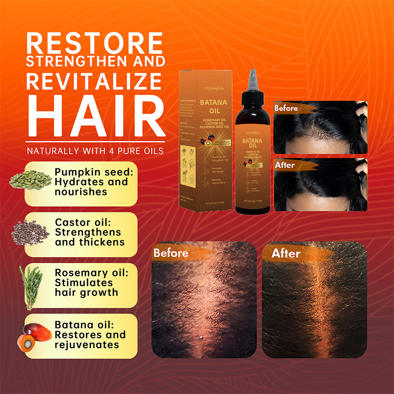 🎉 Giving you a lush head of hair!- Gypsophila™Batana Hair Growth Oil