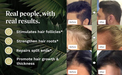 Batana oil and Rosemary oil, for promoting Hair Growth, Nourishing the scalp, Strengthening healthy hair,Organic Batana Oil reducing hair loss, and detoxifying the scalp(30 mL).Suitable for both women and men,Haircare Daily