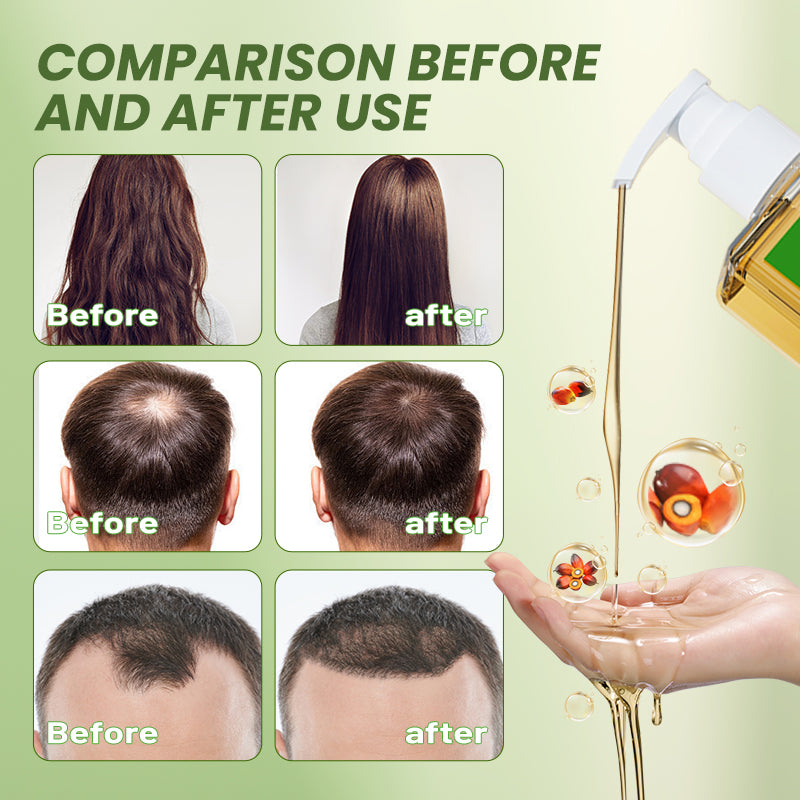 ❤️‍🔥Gypsophila BATANA OIL SHAMPOO-❤️‍🔥 Rich in antioxidants for promoting hair growth