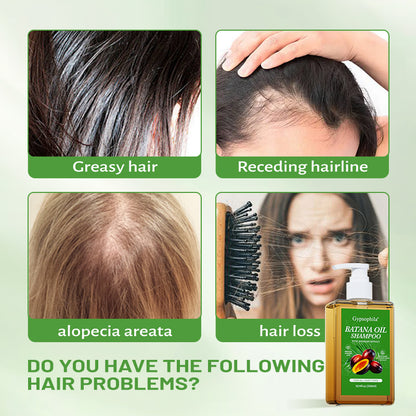 ❤️‍🔥Gypsophila BATANA OIL SHAMPOO-❤️‍🔥 Rich in antioxidants for promoting hair growth