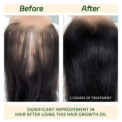 Batana oil and Rosemary oil, for promoting Hair Growth, Nourishing the scalp, Strengthening healthy hair,Organic Batana Oil reducing hair loss, and detoxifying the scalp(30 mL).Suitable for both women and men,Haircare Daily