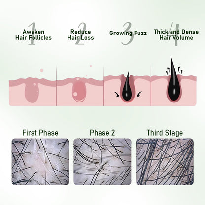 💫Batana Hair Growth Combination-🧭🚀limited-time promotion (on sale)🔥🔥🔥